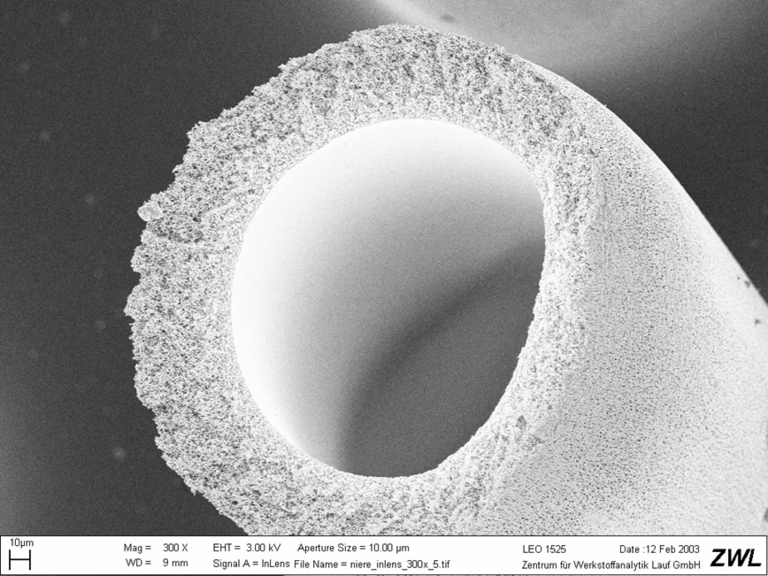 REM image: porous tube material