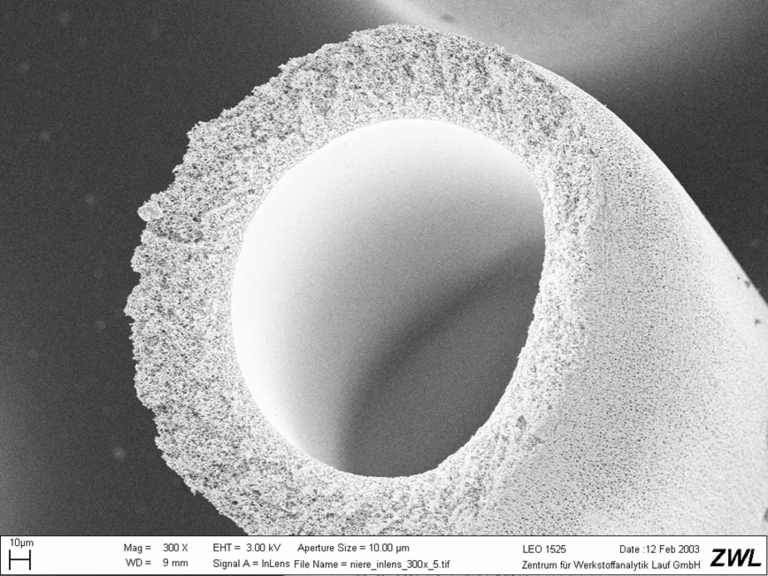 REM-Aufnahme: poröses Schlauchmaterial