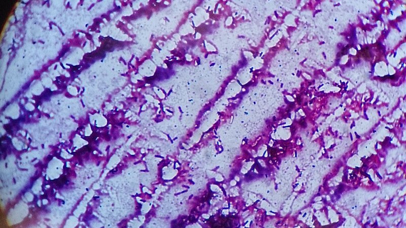 Bioanalytik: Blick durchs Mikroskop